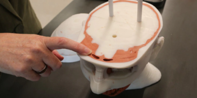 Brisbane bio-tech lab creates 'revolutionary' 3D-printed body parts to treat cancer patients
